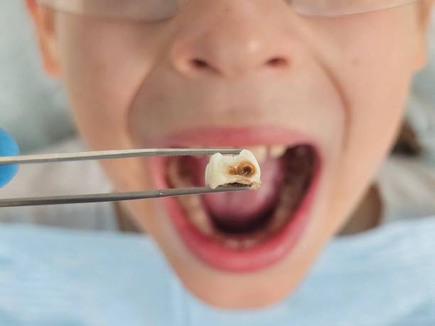 Best Pediatric Emergency Dentist in Cudjoe Key, FL